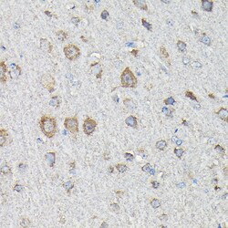 Invitrogen MTHFD1L Polyclonal Antibody 100 &mu;L; Unconjugated:Antibodies,