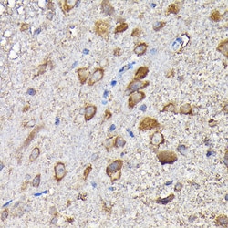 Invitrogen MTHFD1L Polyclonal Antibody 100 &mu;L; Unconjugated:Antibodies,