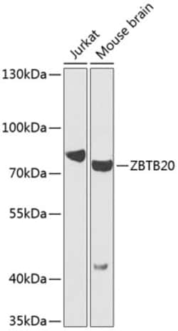 Invitrogen ZBTB20 Polyclonal Antibody 100 &mu;L; Unconjugated:Antibodies,
