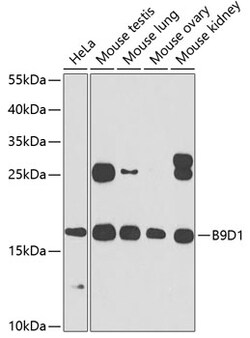 Invitrogen B9D1 Polyclonal Antibody 100 &mu;L; Unconjugated:Antibodies,