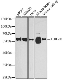 Invitrogen RAP1 Polyclonal Antibody 100 &mu;L; Unconjugated:Antibodies,