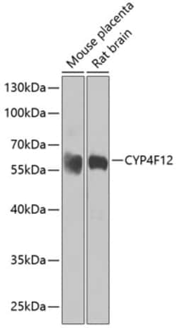 Invitrogen CYP4F12 Polyclonal Antibody 100 &mu;L; Unconjugated:Antibodies,