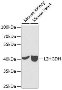 Invitrogen L2HGDH Polyclonal Antibody 100 &mu;L; Unconjugated:Antibodies,