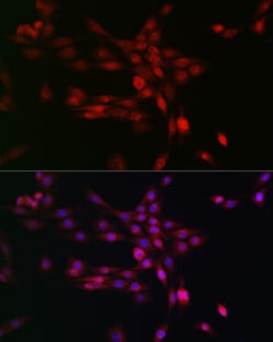 Invitrogen PHD3 Polyclonal Antibody 100 &mu;L; Unconjugated:Antibodies,