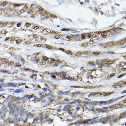 Invitrogen PHD3 Polyclonal Antibody 100 &mu;L; Unconjugated:Antibodies,