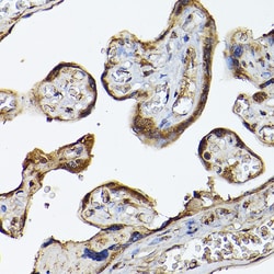 Invitrogen PHD3 Polyclonal Antibody 100 &mu;L; Unconjugated:Antibodies,