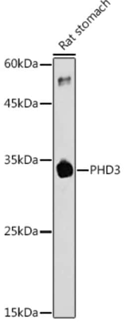 Invitrogen PHD3 Polyclonal Antibody 100 &mu;L; Unconjugated:Antibodies,