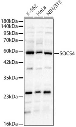Invitrogen SOCS4 Polyclonal Antibody 100 &mu;L | Buy Online | Invitrogen&trade; | Fisher Scientific