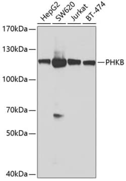 Invitrogen PHKB Polyclonal Antibody 100 &mu;L | Buy Online | Invitrogen&trade; | Fisher Scientific