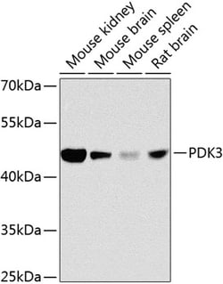 PDK3 Polyclonal Antibody 100 &mu;L | Buy Online | Invitrogen | Fisher Scientific