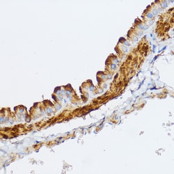 Invitrogen MYLK Polyclonal Antibody 100 &mu;L; Unconjugated:Antibodies,