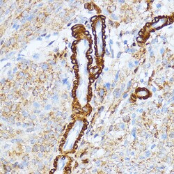 Invitrogen MYLK Polyclonal Antibody 100 &mu;L; Unconjugated:Antibodies,