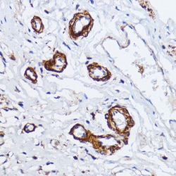 Invitrogen MYLK Polyclonal Antibody 100 &mu;L; Unconjugated:Antibodies,