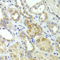 Invitrogen HMGCL Polyclonal Antibody 100 &mu;L; Unconjugated:Antibodies,