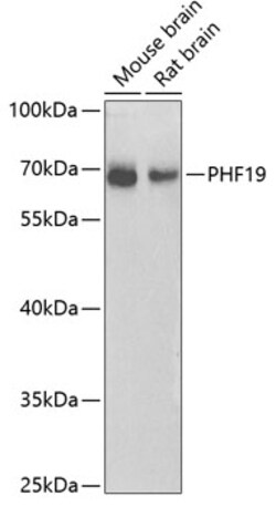 Invitrogen PHF19 Polyclonal Antibody 100 &mu;L | Buy Online | Invitrogen&trade; | Fisher Scientific