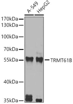 Invitrogen TRMT61B Polyclonal Antibody 100 &mu;L; Unconjugated:Antibodies,