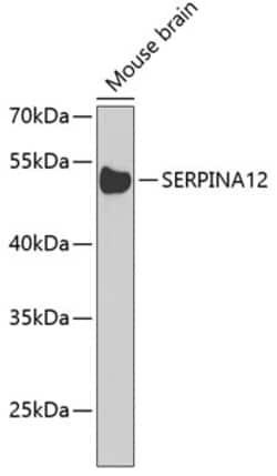 Invitrogen SERPINA12 Polyclonal Antibody 100 &mu;L; Unconjugated:Antibodies,
