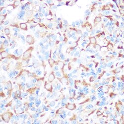 Invitrogen PRAMEF20 Polyclonal Antibody 100 &mu;L; Unconjugated:Antibodies,