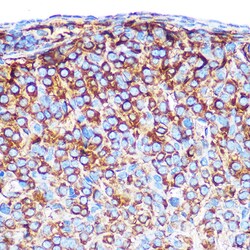 Invitrogen PRAMEF20 Polyclonal Antibody 100 &mu;L; Unconjugated:Antibodies,