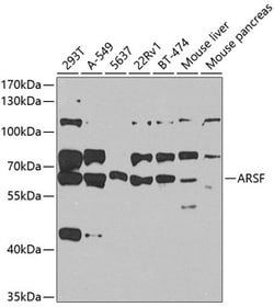 Arylsulfatase F Polyclonal Antibody 100 &mu;L | Buy Online | Invitrogen | Fisher Scientific