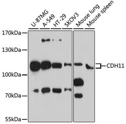 Invitrogen CDH11 Polyclonal Antibody 100 &mu;L; Unconjugated:Antibodies,
