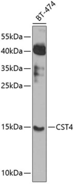 Invitrogen Cystatin S Polyclonal Antibody 100 &mu;L; Unconjugated:Antibodies,