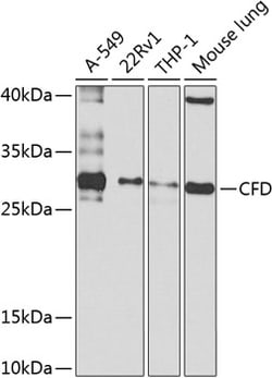 Invitrogen Complement Factor D Polyclonal Antibody 100 &mu;L; Unconjugated:Antibodies,