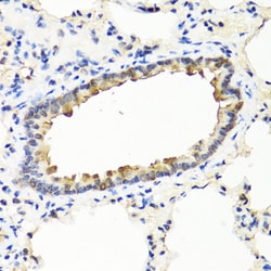 Invitrogen IFN omega Polyclonal Antibody 100 &mu;L; Unconjugated:Antibodies,
