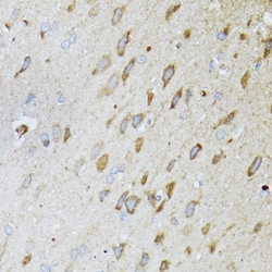Invitrogen MT-ND5 Polyclonal Antibody 100 &mu;L | Buy Online | Invitrogen&trade; | Fisher Scientific
