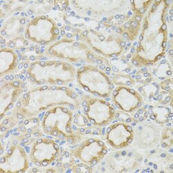 Invitrogen MT-ND5 Polyclonal Antibody 100 &mu;L | Buy Online | Invitrogen&trade; | Fisher Scientific