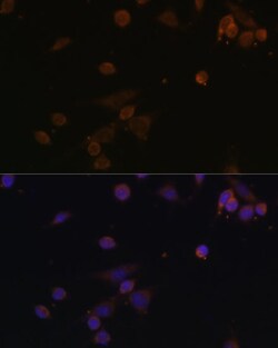 Invitrogen NDUFA2 Polyclonal Antibody 100 &mu;L; Unconjugated:Antibodies,