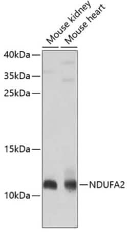 Invitrogen NDUFA2 Polyclonal Antibody 100 &mu;L; Unconjugated:Antibodies,