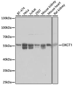 Invitrogen OXCT1 Polyclonal Antibody 100 &mu;L | Buy Online | Invitrogen&trade; | Fisher Scientific