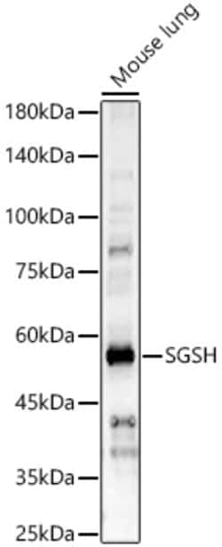 Invitrogen SGSH Polyclonal Antibody 100 &mu;L; Unconjugated:Antibodies,