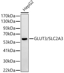 Invitrogen GLUT3 Polyclonal Antibody 100 &mu;L; Unconjugated:Antibodies,