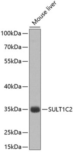 Invitrogen SULT1C2 Polyclonal Antibody 100 &mu;L; Unconjugated:Antibodies,