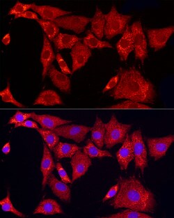 Invitrogen SLC25A11 Polyclonal Antibody 100 &mu;L; Unconjugated:Antibodies,