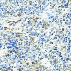 Invitrogen SLC25A11 Polyclonal Antibody 100 &mu;L; Unconjugated:Antibodies,