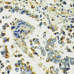 Invitrogen SLC25A11 Polyclonal Antibody 100 &mu;L; Unconjugated:Antibodies,