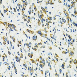 Invitrogen SLC25A11 Polyclonal Antibody 100 &mu;L; Unconjugated:Antibodies,