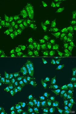 Invitrogen Nuclear Matrix Protein p84 Polyclonal Antibody 100 &mu;L; Unconjugated:Antibodies,