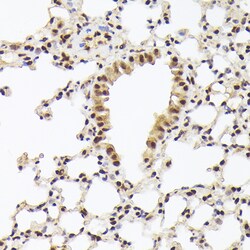 Invitrogen Nuclear Matrix Protein p84 Polyclonal Antibody 100 &mu;L; Unconjugated:Antibodies,