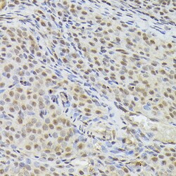Invitrogen Nuclear Matrix Protein p84 Polyclonal Antibody 100 &mu;L; Unconjugated:Antibodies,