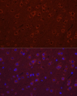 Invitrogen SYT11 Polyclonal Antibody 100 &mu;L | Buy Online | Invitrogen&trade; | Fisher Scientific