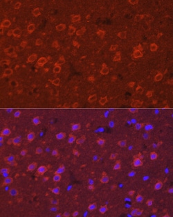 Invitrogen SYT11 Polyclonal Antibody 100 &mu;L | Buy Online | Invitrogen&trade; | Fisher Scientific