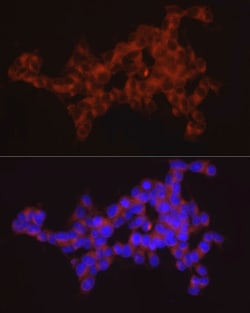 Invitrogen SYT11 Polyclonal Antibody 100 &mu;L | Buy Online | Invitrogen&trade; | Fisher Scientific