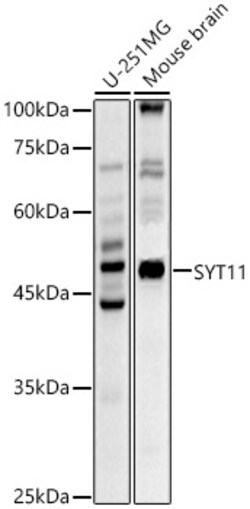 Invitrogen SYT11 Polyclonal Antibody 100 &mu;L | Buy Online | Invitrogen&trade; | Fisher Scientific