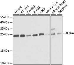 Invitrogen IL1F6 Polyclonal Antibody 100 &mu;L; Unconjugated:Antibodies,