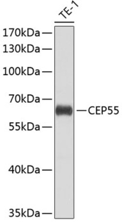 Invitrogen CEP55 Polyclonal Antibody 100 &mu;L | Buy Online | Invitrogen&trade; | Fisher Scientific