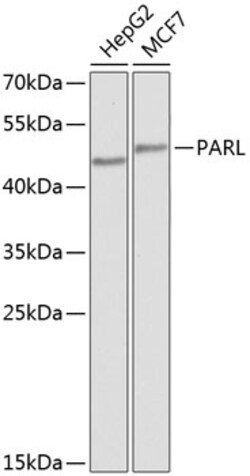 Invitrogen PARL Polyclonal Antibody 100 &mu;L; Unconjugated:Antibodies,